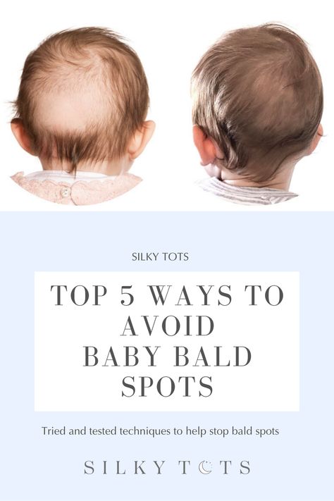 The Leading cause for baby bald spots on the back of their head is friction caused by lying on their backs for long periods of time. We have put together some tried and tested techniques to help your baby retain their hair and keep it healthy, silky & smooth while you're at it! Baby Bald Spot Tips, Newborn Hair Care, Baby Losing Hair, Baby Head Shape, Newborn Hair, Baby Essentials Newborn, Newborn Baby Care, Newborn Baby Tips, Milestone Pictures