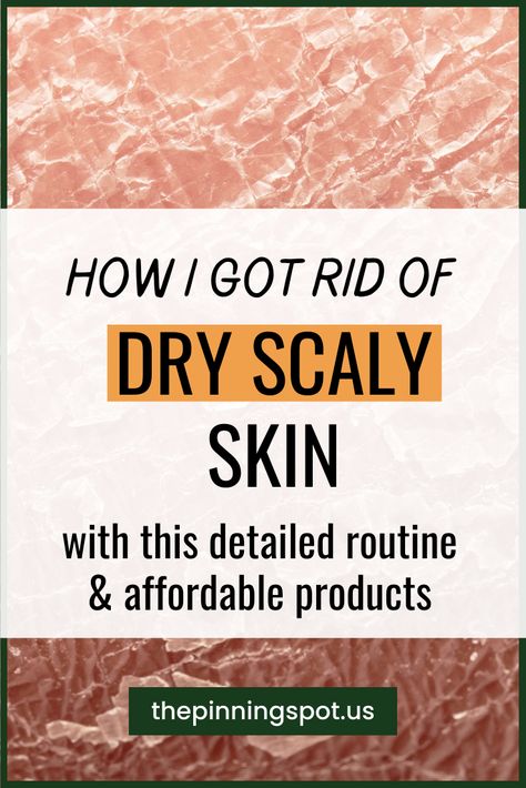 I caused my dry scaly skin trying to get rid of my oily skin. And so to get rid of my dry, scaly skin on face and legs I used this budget-friendly care routine as well as moisturizers to hydrate my skin. These are all the solutions to my dry scaly skin I used, what worked to get rid of my dry scaly skin and what did not work. I hope you find this helpful as you tackle your dry ashy skin. Let's get into it. Skincare Routine For Dry Dull Skin, Dry Skin On Body Remedies, Scaly Legs Remedy Dry Skin, Natural Dry Skin Remedies, Dry Irritated Skin On Face, How To Help Dry Skin, Face Oils For Dry Skin, Super Dry Skin Remedies, Dry Legs Remedy How To Get Rid