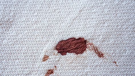 Period Stain, Blood Out Of Carpet, Remove Blood Stains, Carpet Cleaning Recipes, Chocolate Stains, Clean Car Carpet, Carpet Cleaning Business, Removing Carpet, Deep Carpet Cleaning