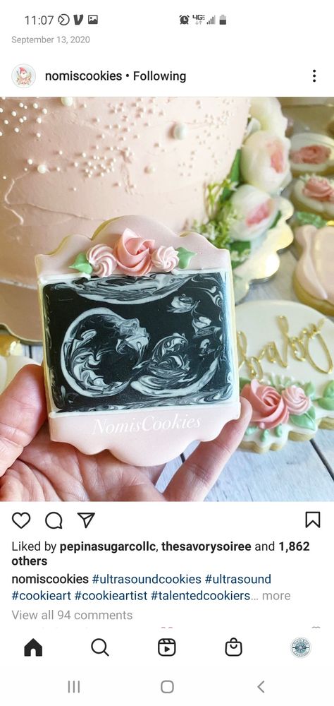 Sonogram Picture Cookies, Ultrasound Cookies Decorated, Ultrasound Cookies, Sonogram Pictures, Ultrasound Pictures, Baby Scan, Edible Printing, Baby Cookies, Fancy Cookies