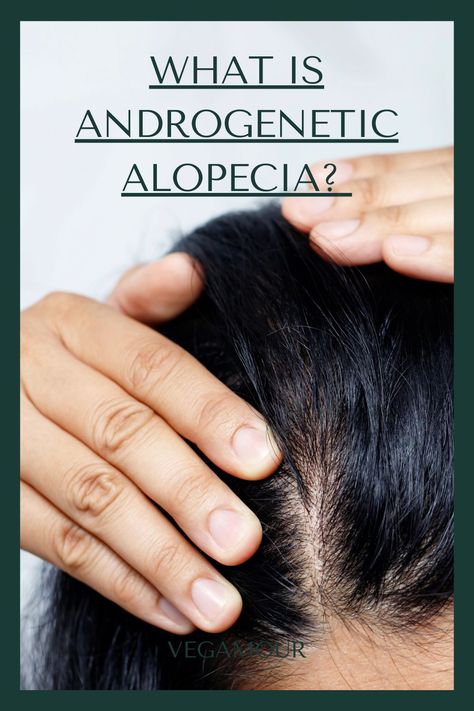 Androgenic Alopecia In Women, Alopecia Causes, Telogen Effluvium, Alopecia Hairstyles, Androgenic Alopecia, Traction Alopecia, Androgenetic Alopecia, Hair Growth Cycle, Aging Hair