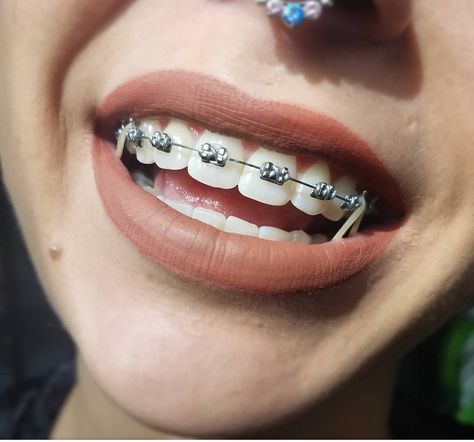 Makeup For Brunettes, Braces Colors Ideas, Zoom Teeth Whitening, Cute Braces Colors, Adult Braces, Braces Tips, Getting Braces, Braces Girls, Cute Braces