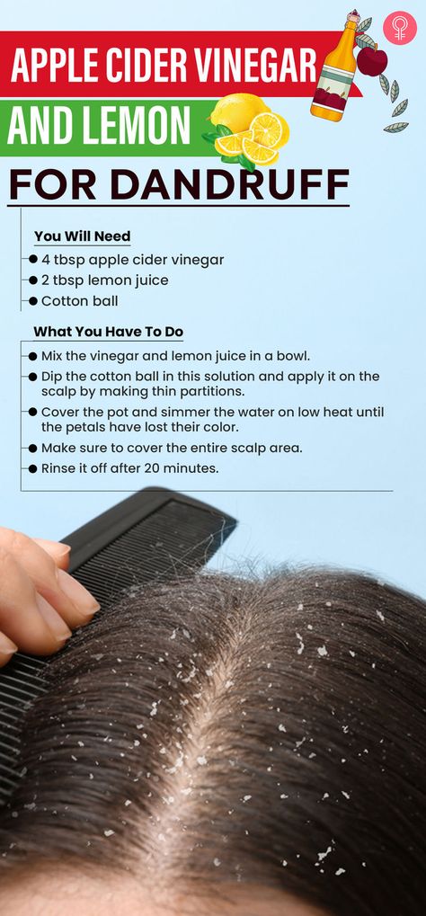 How To Use Lemon To Get Rid Of Dandruff? Tap into the anti-dandruff properties of this fruit to fight those pesky flakes. Lemon For Dandruff, Rid Of Dandruff, Dandruff Remedy, Getting Rid Of Dandruff, Flaky Scalp, Front Hair, Hair Dandruff, Front Hair Styles, Anti Dandruff