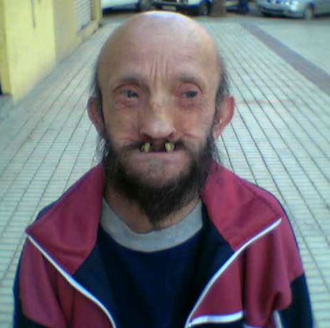 World's Ugliest Guys - Gallery Teeth Humor, Old Man Pictures, Funny Faces Pictures, Beteg Humor, Bad Teeth, Short People, Face Pictures, Funny Images Laughter, Bounty Hunter