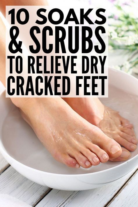 fungal nail pedicure Crusty Feet Dry Skin, At Home Foot Soak, Diy Pedicure At Home Soak, Diy Foot Soak For Dry Feet Heels, Foot Scrub Diy Exfoliating, Foot Pedicure Diy At Home, Footsoak Diy, Foot Care Routine At Home, Foot Soak For Calluses