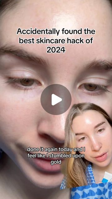 Natalie O’Neill on Instagram: "Sebaceous filaments be gone ✨ I filmed this on the same day that I posted the original 🎀 #sebaceousfilaments #blackheads" Sebaceous Filaments Removal, Beauty Education, Blackheads On Face, Face Massage Anti Aging, Sebaceous Filaments, Anti Aging Skincare Routine, Fav Products, Get Rid Of Blackheads, Diy Beauty Recipes