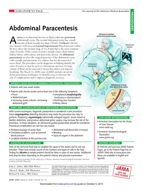 paracentesis procedure Paracentesis Nursing, Thoracic Surgery, Gi System, Nursing Cheat Sheet, Radiologic Technology, Nursing Cheat, Gastrointestinal System, Rara Avis, Medical Billing And Coding