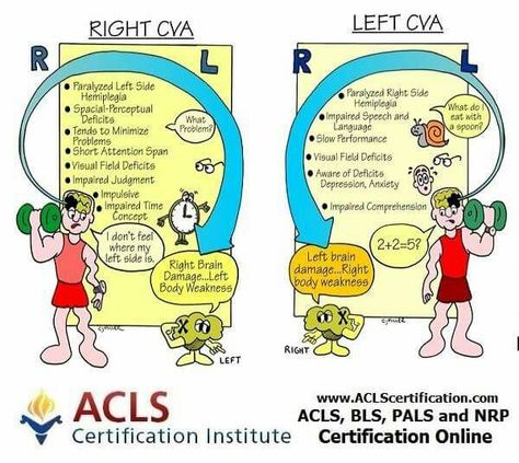 Right cva vs left cva Nursing Pneumonics, Neuro Nursing, Emt Study, Nurse Teaching, Nursing Cheat, Med Surg Nursing, Nursing School Essential, Nursing Study Guide, Left Brain