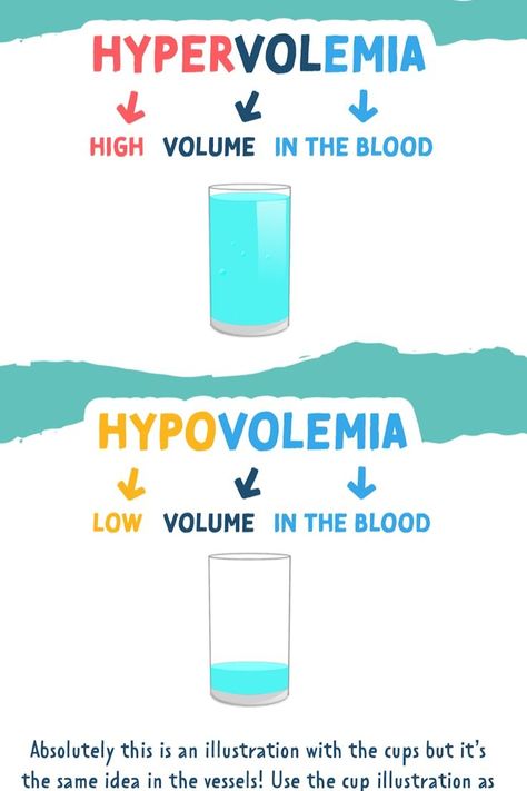 FREE Hypervolemia vs. Hypovolemia Study Guide #NurseInTheMaking #Nurseinthemake #Nurseinthemakingbundle #Nursingbundle #Thecompletenursingschoolbundle #NursingStudent #Nursingnote #Nursingschoolbundle #Nurseinthemakebundle #Nursing #Nurseinthemakingpharmacology #Pharmacology #Bundle #Nursingnotes Hypovolemia Vs Hypervolemia, Hypervolemia Nursing, Hypovolemia Nursing, Advanced Emt, Study Pharmacy, Electrolytes Nursing, Med Surge, Nurse In The Making, Nurse Bae