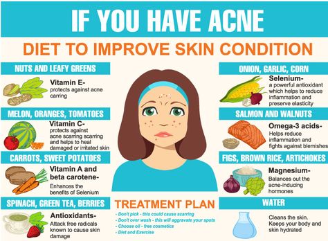 Holistic Tips, Clear Skin Fast, Acne Diet, Vitamin C Benefits, Skin Care Routine For 20s, Clear Skin Tips, Skin Condition, Vitamins For Skin, Prevent Acne