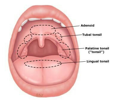 Lingual tonsils, part of the waldeyer's ring Waldeyer's ring : adenoids (pharyngeal tonsils) Tubal tonsils palatine tonsils Lingual tonsils Lingual Tonsils, Human Body Vocabulary, Human Body Projects, 30 Day Plank, Human Body Organs, Nursing Programs, Lose Pounds, Nursing Notes, Body Organs