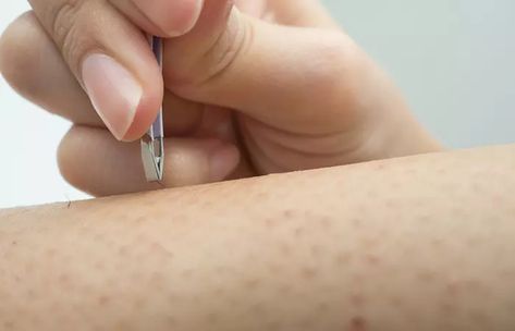 How To Get Rid Of Ingrown Hair - Simple Tips To Prevent Ingrown Hair Under Armpit, Ingrowing Hair, Infected Ingrown Hair, Treat Ingrown Hair, Bump Hairstyles, Ingrown Hair Removal, Hair Curl, Prevent Ingrown Hairs, Ingrown Hairs