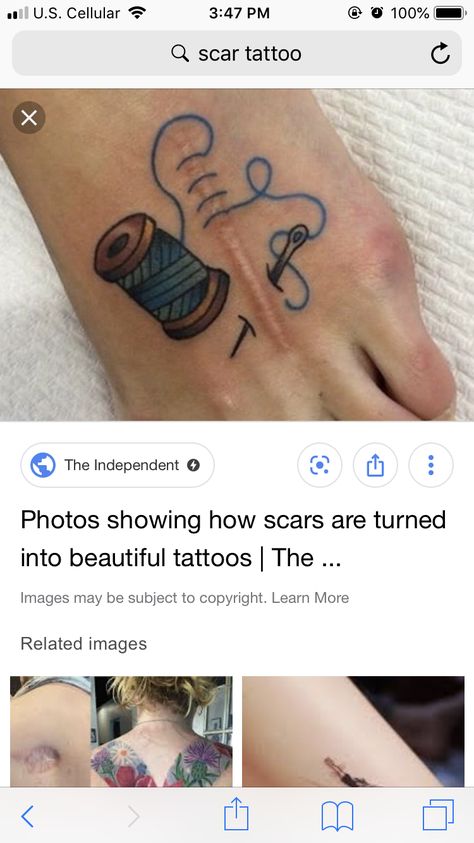 Ankle Surgery Scar Tattoo, Needle And Thread Tattoo, Sewing Tattoo Design, Sewing Tattoos, Ankle Surgery, Scar Tattoo, 3d Tattoos, 3d Tattoo, Thread Spools