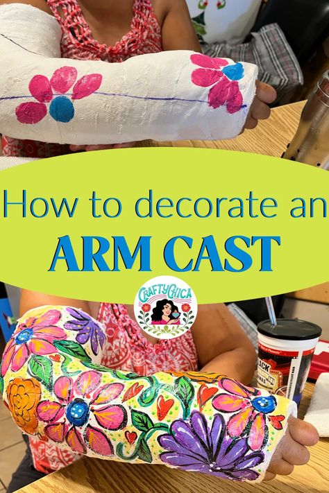 Decorating Casts Arm, Cast Designs Arm, Cast Art Arm, Arm Cast Decorating Ideas, Cast Painting, Cast Decoration, Kids Cast, Aphmau Pictures, Baby Cast