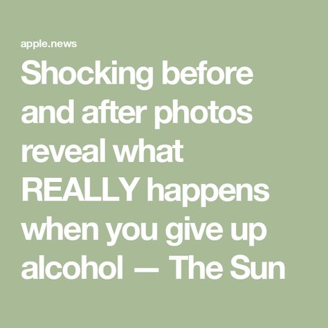 Shocking before and after photos reveal what REALLY happens when you give up alcohol — The Sun Before And After Alcohol Pictures, Never Drinking Again, Giving Up Drinking, Giving Up Alcohol, Made In Chelsea, What Really Happened, After Photos, Anne Hathaway, Cara Delevingne