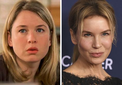 15 Celebrity Women Who Got Chiseled Cheekbones and Drastically Changed Their Face Low Cheekbones Women, Low Cheekbones, Cheek Fat, Bridget Jones Diary, Common Knowledge, Face Change, Renee Zellweger, Sarah Hyland, Bridget Jones