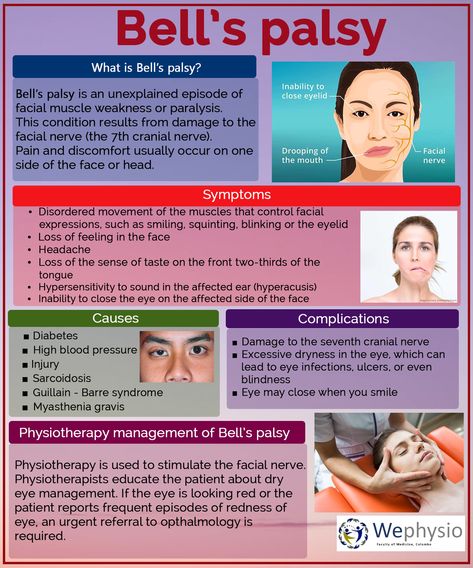 Bell’s palsy Bell’s Palsy, Bells Palsy, Nursing School Essential, Eye Twitching, Muscle Twitching, Nurse Study Notes, Facial Nerve, Nursing Student Tips, Physical Therapy Exercises