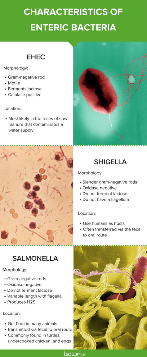 Do you know the characteristics of enteric bacteria? Here, you can find all the important facts of Microbiology and get tips to master your time in medical school! Get more information by clicking on this infographic! #Microscopic Bacteria Microbiology, Clinical Microbiology, Microbiology Notes, Nursing School Clinicals, Medical Microbiology, Medical Laboratory Science Student, Microbiology Study, What Is Nursing, Medical Laboratory Technician