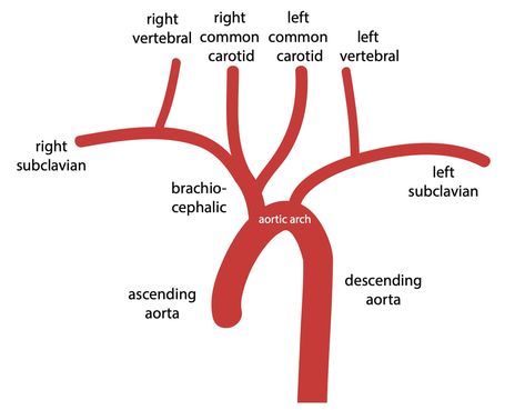 Maxillary Artery, Common Carotid Artery, Aortic Arch, High Blood Sugar Symptoms, How To Help Nausea, Carotid Artery, Liver Diet, Cramps Relief, Clogged Arteries