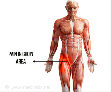 Groin pain is the discomfort or pain in the fold between the lower abdomen and thighs. Groin pain is a common injury among athletes. Stretch Groin Muscle, Groin Pain Relief Women, Groin Stretches For Pain, Torso Muscles, Groin Muscles, Trapped Nerve, Nerve Conduction Study, Referred Pain, Hip Injuries