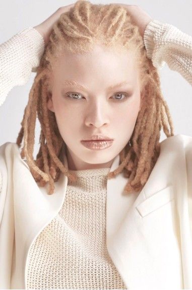 Albino Model, Albino Girl, Model Tips, Dreads Girl, Female Character Inspiration, Personal Assistant, Aesthetic People, Poses References, Hair Reference