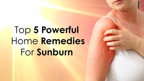 How to Get Rid of Sunburn Redness Overnight | Top 5 Powerful Home Remedies Home Remedies For Sunburn, Get Rid Of Sunburn, Heal Sunburn, Natural Remedies For Sunburn, Sunburn Remedies, Sunburn Relief, Skin Tea, Baby Sunscreen, Fresh Aloe Vera