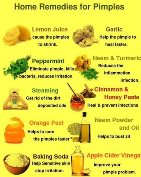 Here Are 15 DIY Hacks, Tips and Tricks That Will Make That Acne Vanish Overnight! beauty diy health viral viral right now viral posts Acne Recipes, Remedies For Pimples, Home Remedies For Pimples, Get Rid Of Pimples, Rid Of Pimples, Acne Overnight, Pimples Overnight, Pimples Remedies, Natural Acne Remedies