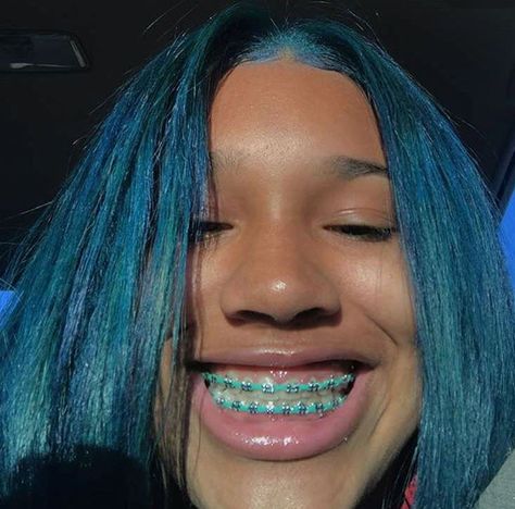 Braces Colors Combinations, Braces Retainer, Green Braces, Braces And Glasses, Maquillage Kylie Jenner, Braces Smile, Cute Braces Colors, Braces Tips