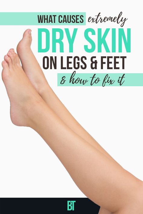 Extremely dry, itchy skin can be a problem! Check what can be the causes and how to treat dry skin on legs and feet. Dry Skin Legs, Dry Peeling Skin, Itchy Skin Remedy, Dry Legs, Dry Skin Problem, Extremely Dry Skin, Dry Flaky Skin, Dry Skin Remedies, Dry Itchy Skin