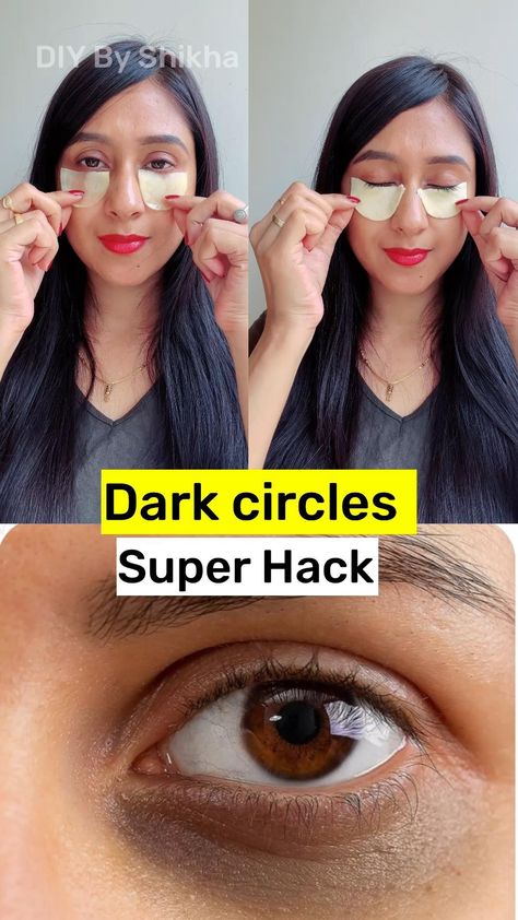 What Deficiency Causes Dark Circles Under Eyes? Remove Eye Bags, Dark Eye Circles, Natural Skin Care Remedies, Natural Face Skin Care, Good Skin Tips, Under Eye Wrinkles, Remove Dark Circles, Dark Circles Under Eyes, Perfect Skin Care Routine