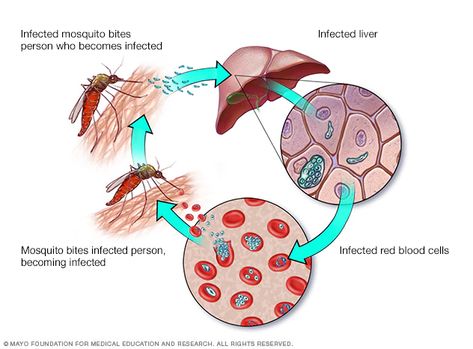 Human Health And Disease, Malaria Symptoms, Fenugreek Tea, Malaria Parasite, How To Control Sugar, Lower Blood Sugar Naturally, Diagram Design Ideas, Reduce Blood Sugar, Low Blood Sugar Levels