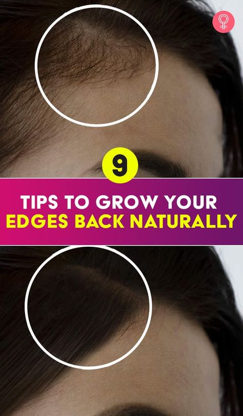 9 Tips To Grow Your Edges Back Naturally: How can you grow your edges back? This fragile hair needs extra care. If you continue over-handling them by wearing tight hairstyles like braids or weaves, they may break off and eventually cause hair loss. Grow Edges, Grow Hair Back, Hair Growth Methods, Thinning Edges, Stop Hair Breakage, Growing Healthy Hair, Breaking Hair, Hair Growing Tips, Edges Hair