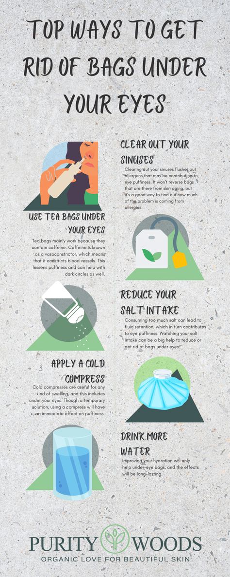 15 Natural Ways to Get Rid of Bags Under Eyes - Purity Woods Tips For Eye Bags, Puffy Under Eyes Bags Products, How To Prevent Eye Bags, How To Get Rid Of Black Bags Under Eyes, How To Grt Rid Of Bags Under Your Eyes, How To Get Ride Of Bags Under Eyes Fast, Eye Bags Remedy How To Get Rid, How To Treat Under Eye Bags, Malar Bags Remedy