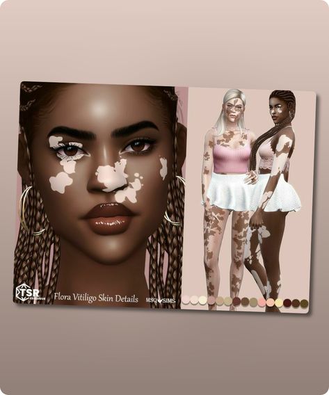 Sims 4 Skins / Skindetail CC: Flora Vitiligo Skin Details By Msqsims Sims 4 Cc Vitíligo Skin, Sims 4 Vitíligo Cc, Sims 4 Skins, Sims Skins, Sims 4 Cc Download, Skin Details, Sims 4 Cc Skin, Model Nails, Skin Colors