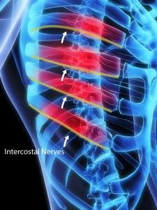 INTERCOSTAL NERVE BLOCK-is a highly specialized procedure used to treat pain in the chest and upper abdomen. Intercostal Neuralgia, Rib Pain, Severe Back Pain, Broken Ribs, Chronic Pain Relief, Pinched Nerve, Alternative Therapies, Nerve Pain, Core Strength