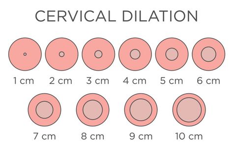 Cervix Dilation Chart: Signs, Stages And Procedure To Check Cervical Dilation Chart, Cervix Dilation Chart, Dilation Chart, Cervical Effacement, Dilation And Effacement, Cervix Dilation, Cervical Dilation, Phases Of Labor, Mucus Plug