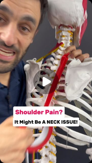 Stiff Shoulder And Neck, Rotator Cuff Muscles, Rotator Cuff Pain, Radial Nerve, Muscles Of The Neck, Shoulder Problem, Stiff Shoulder, Shoulder Mobility, Neck And Shoulder Pain