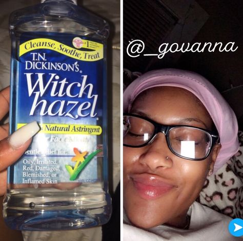 First soak a cotton swap up with witch hazel. Then you will wipe your face with the swab. You will then let the witch hazel dry. Finally you can add coconut oil , tea tree oil and or vitamin E oil to your face. ( witch hazel is a astringent which can dry your skin out if you don’t put oil on your face after you use it)! Witch Hazel Skin Care, Witch Hazel Tea, Witch Hazel Uses Skin Care, Witch Hazel Uses, Witch Hazel For Skin, Period Hacks, Face Tips, Hygiene Care, Aesthetic Life