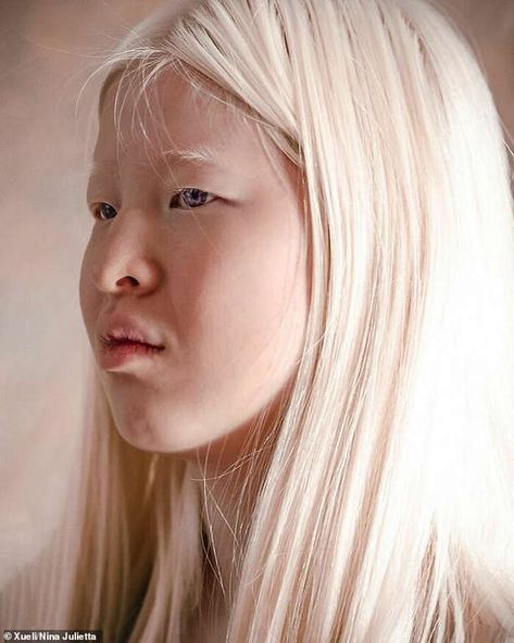 Albino model who was abandoned as a baby in China features in Vogue Celebrate Differences, Albino Model, Albino Girl, Earth Clothes, Blonde Hair Goals, No Future, Vogue Models, Baby Due, Asian Kids