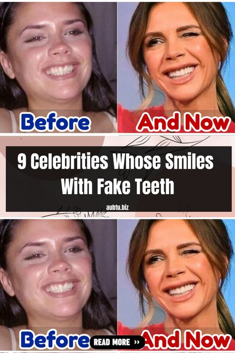 Celebrity Teeth, Picture Perfect Smile, Fake Teeth, Prettiest Celebrities, Good Will Hunting, Internet Games, Smile Makeover, Chris Rock, Perfect Smile