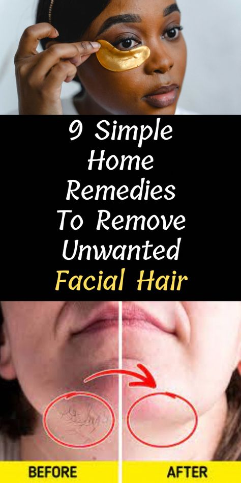 Remove Unwanted Facial Hair Bear in mind that we also have weather conditions not favorable for a healthy skin. Hope these tricks help...... Types Of Facial Hair, Face Hair Removal, Unwanted Hair Permanently, Natural Hair Removal, Remove Unwanted Facial Hair, Underarm Hair Removal, Unwanted Facial Hair, Excess Hair, Hair Removal Methods