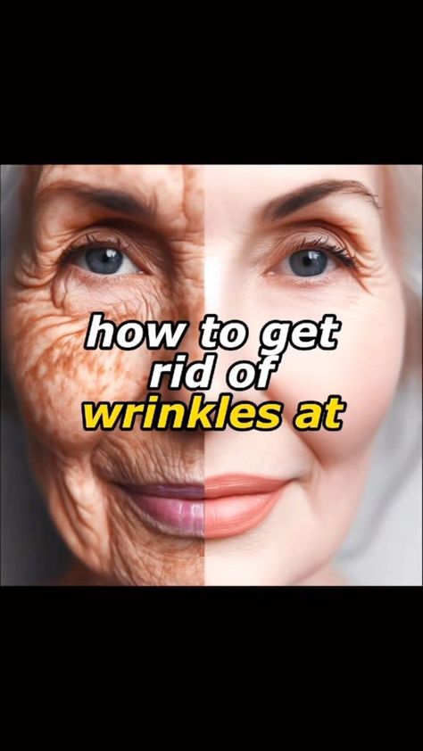 Say Goodbye to Wrinkles at Home 👩🏽‍🦳 Discover an easy home remedy to reduce wrinkles naturally! Learn how to create an orange-based cream… | Instagram 🌷 Get Youthful Glow - Click Here! forehead wrinkles, wrinkles remedies face 😘 Please re-pin 😍💞 How To Remove Wrinkles On Face, How To Get Rid Of Wrinkles, Face Taping For Wrinkles, Wrinkle Remedies Face, Remove Wrinkles From Face, Natural Wrinkle Reducer, Natural Wrinkle Remedies, Wrinkles Remedies, Wrinkles Remedies Face