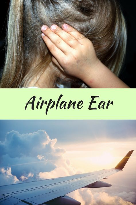 Airplane Ear- By Living Herself Many people complain that they have ear problems during fights. It's very normal to have ear problems during flight because of the pressure changes during flight. Generally, these changes don't cause a lasting trouble but in few cases who have persisting problems might land up with an ear trouble which is Airplane Ear. Ear Popping Remedies Plane, Airplane Ear Pressure Relief, How To Unstop Ears, How To Unplug Ears, Ear Ache Relief, Fly Remedies, Relieve Ear Pressure, Ear Pressure Relief, Blocked Ears