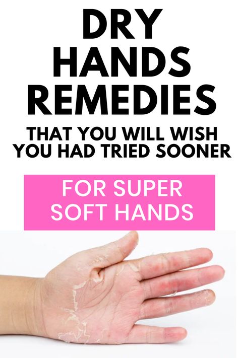 Say goodbye to rough, dry hands with our expert tips and tricks! Discover natural remedies, DIY hand masks, and nourishing hand creams to keep your hands soft and supple, even in the harshest of weather conditions. Follow us for more helpful beauty and skincare advice given by a pharmacist How To Get Soft Hand Palms, Diy Hand Cream For Dry Skin, Best Hand Cream For Dry Hands, Soft Hands Tips, How To Soften Hands, Hand Mask For Dry Hands, Cracked Hands Remedy, Dry Hands Remedy, Hand Masks