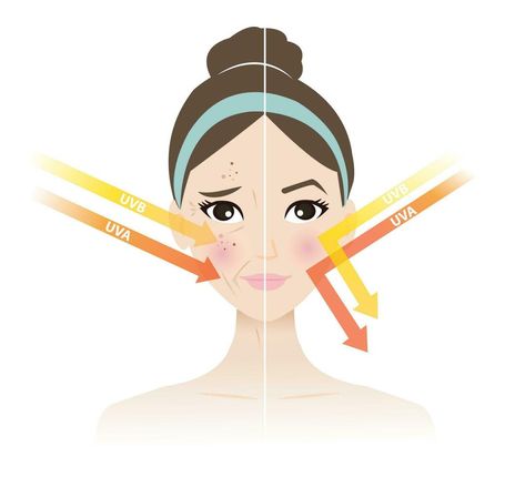 Sun Exposure, Sun Damage, Damaged Skin, Woman Face, Healthy Skin, Vector Art, White Background, Vector Free, Vector Illustration