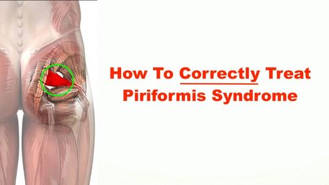 How to Correctly Treat Piriformis Syndrome – Squat University Piriformis Exercises, Piriformis Syndrome Exercises, Squat University, Piriformis Muscle, Piriformis Stretch, Hip Pain Relief, Middle Back Pain, Sciatica Exercises, Piriformis Syndrome