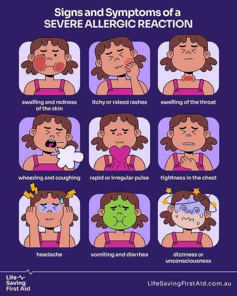 🦐🥜🐝 Knowing the signs of an allergic reaction could save a life! Swipe to learn the key symptoms to watch out for. From rashes to breathing difficulties, early recognition is crucial. 💡🚨🚑  #AllergyAwareness Allergy Rash, Athletic Body Type, First Aid Tips, Nursing School Essential, Mast Cell Activation Syndrome, Allergy Awareness, Mast Cell, Medical Anatomy, Athletic Body