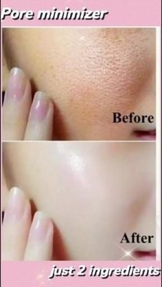 Beginner Skin Care Routine, Facial Massage Routine, Mekap Mata, Clear Healthy Skin, Open Pores, Diy Skin Care Routine, Good Skin Tips, Diy Skin Care Recipes, Basic Skin Care Routine