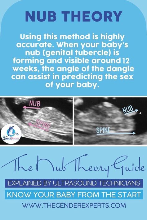 Sonogram Gender Prediction, Skull Theory Gender, 12 Week Ultrasound Gender, Baby Gender Ultrasound, Ultrasound Gender Prediction, Chinese Gender Prediction, Early Gender Prediction, Ramzi Theory, Gender Prediction Chart