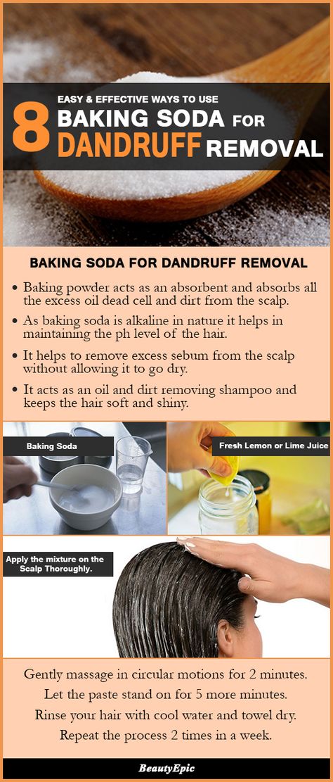 8 Easy and Effective Ways to Use Baking Soda For Dandruff Removal Baking Soda For Scalp, Dandruff Remedy Severe At Home, Baking Soda Scalp Scrub, How To Get Ride Of Dandruff Fast At Home, How To Remove Dandruff From Scalp, How To Remove Dandruff, Baking Soda For Skin, Baking Soda For Dandruff, Dandruff Removal